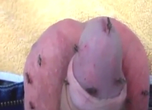 Dude allows mosquitoes to fuck his big cock head